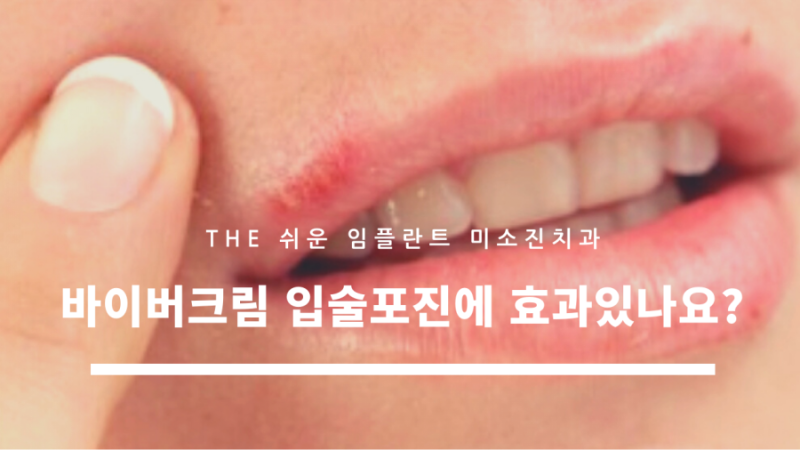 입술포진에 바르는 바이버크림 효과/사용법/가격 : 네이버 블로그