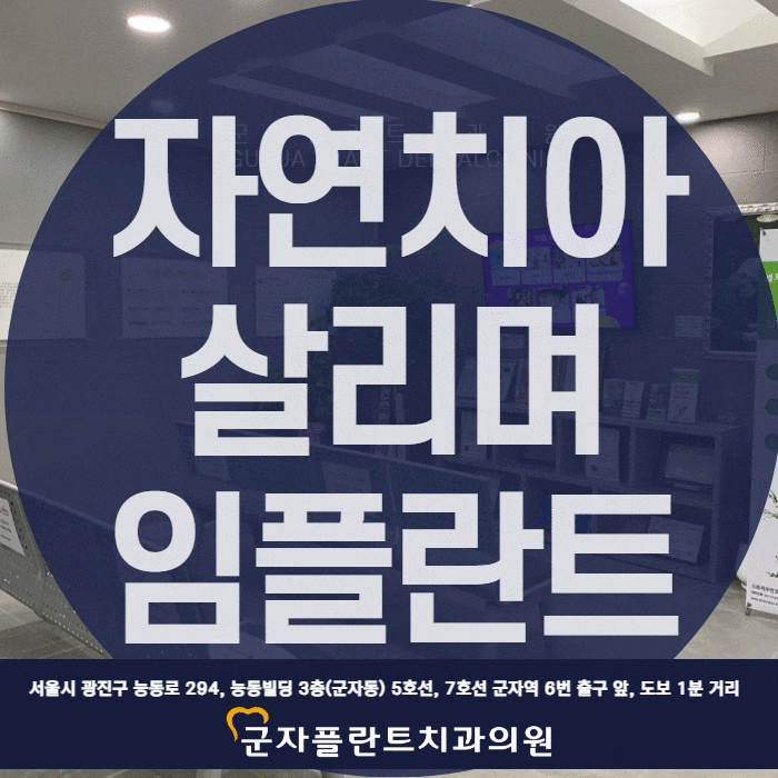 자연치아는 지키며 필요한 임플란트 시술만, 답십리치과추천 자연치아는 지키며 필요한 임플란트 시술만, 답십리치과추천