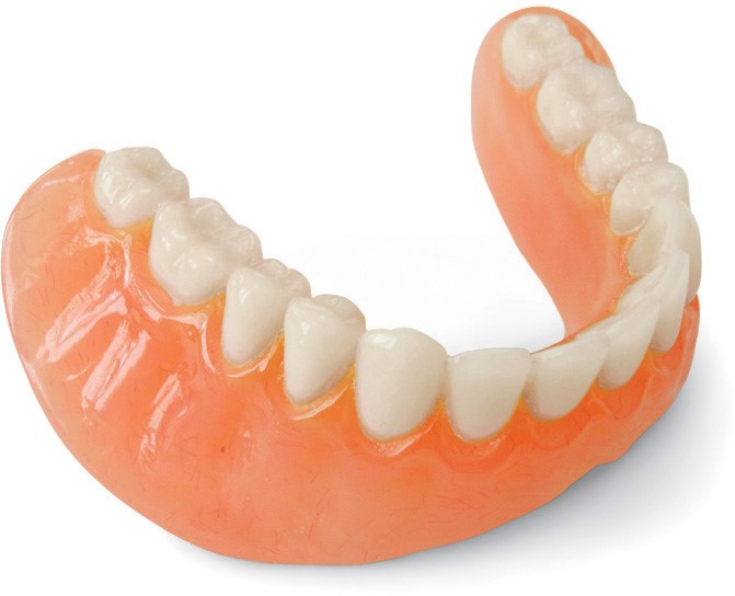치아 보철치료의 종류