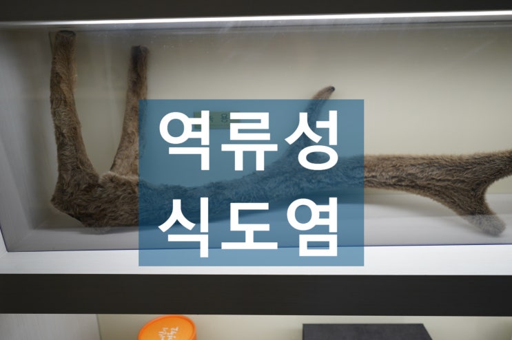  부천역류성식도염 속이 쓰릴 때는 한방치료로