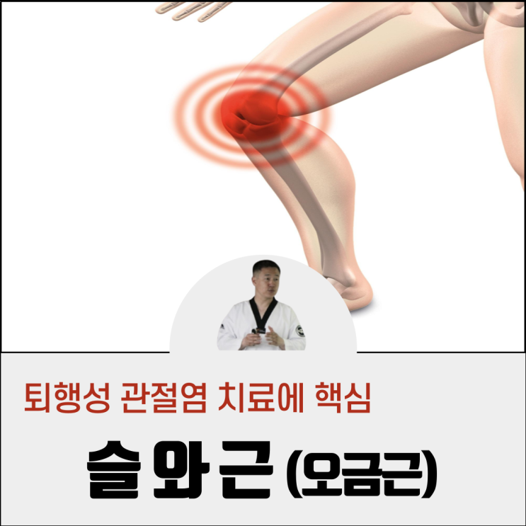  슬와근 퇴행성 관절염 치료에 핵심입니다.