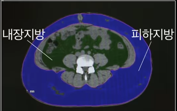  복부비만 빼는 방법