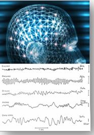 인체가 발생하는 뇌파(EEG)