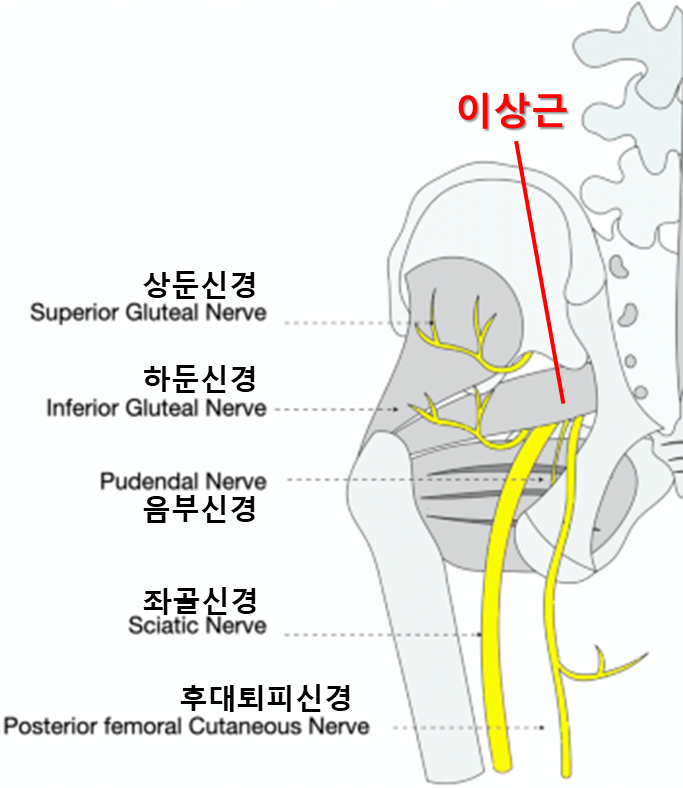 이상근의 신경 포획 - 좌골신경통, 음부신경통, 엉덩이 통증 - 가로세로한의원 일산점