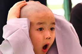  요즘 머리숱이 횡~~해진 것 같은데 어떻게 하지? 탈모 약 미녹시딜에 대해서