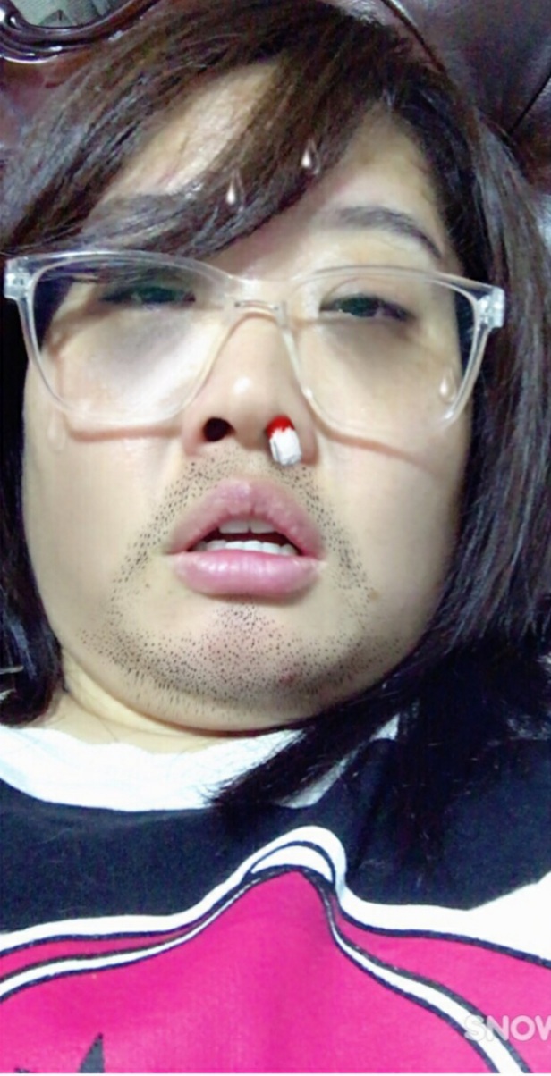  월요일병~!!