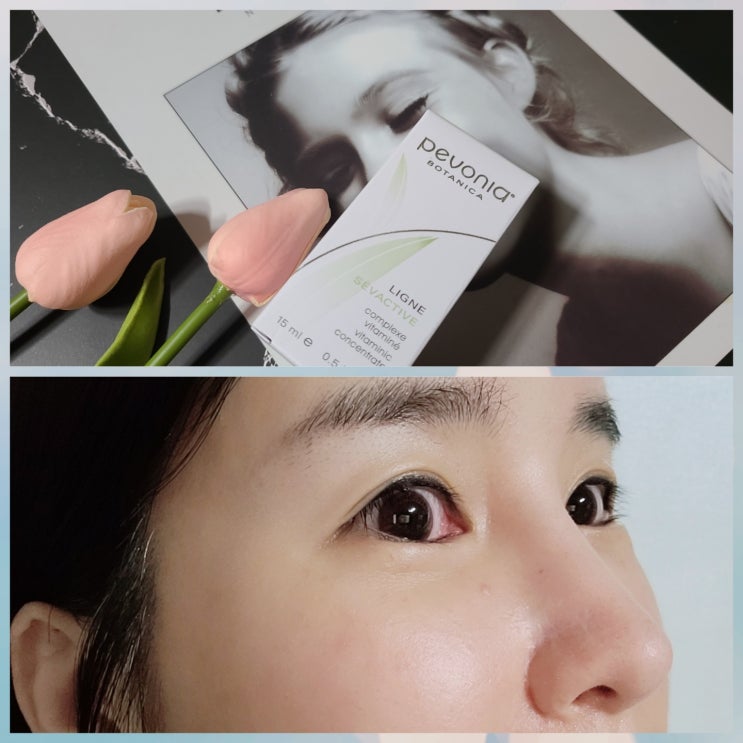 에스테틱 전문 페보니아 비타미닉 컨센트레이트 포토제닉 세럼 남다르다 ! 에스테틱 전문 페보니아 비타미닉 컨센트레이트 포토제닉 세럼 남다르다 !