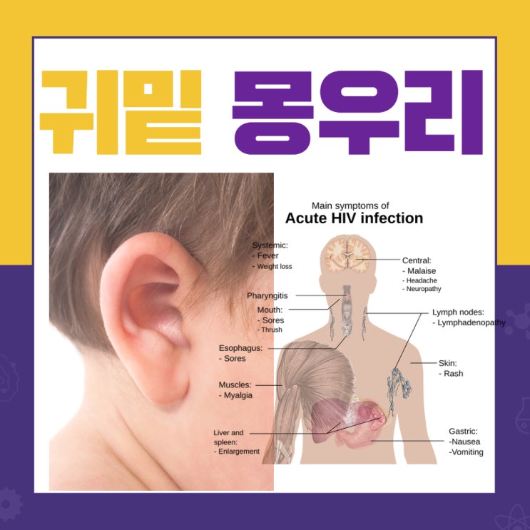  귀밑 몽우리 생기는 여러가지 원인