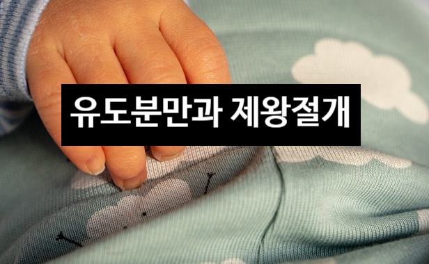  유도분만을 하면 보통 제왕절개를 하게 되나요?