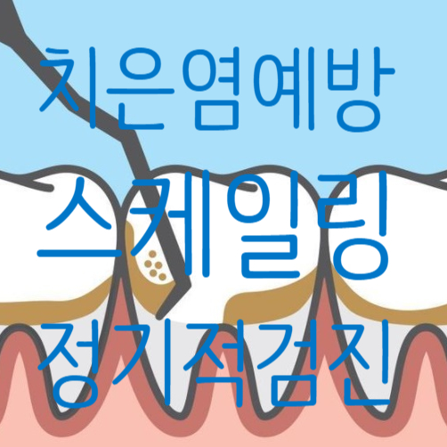  당감동치과 치은염 증상과 원인 예방법