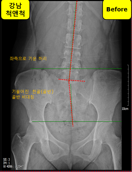 알로벳 이미지