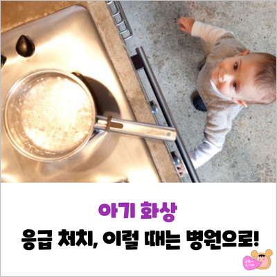  아기 화상 응급 처치하기(물집, 연고, 1,2,3도 화상)