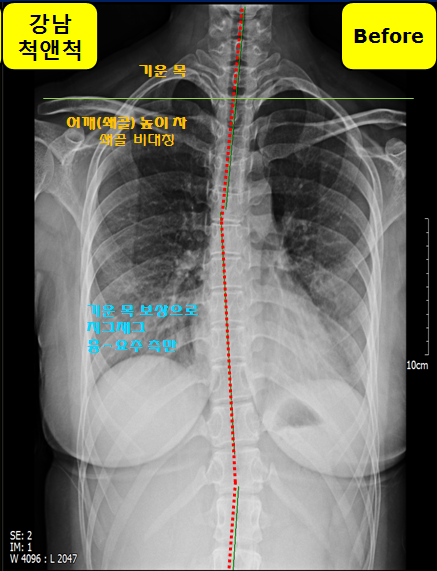 알로벳 이미지