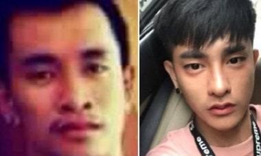 성형외과 고르는법과 주의사항 꿀팁 성형 가격 발품 후기 모음 : 네이버 블로그