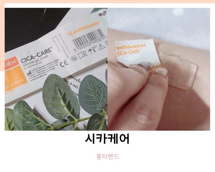 시카케어 겔시트 흉터밴드 재사용 하면 오래 쓸수 있어용 내돈내산 후기 ! 시카케어 겔시트 흉터밴드 재사용 하면 오래 쓸수 있어용 내돈내산 후기 !