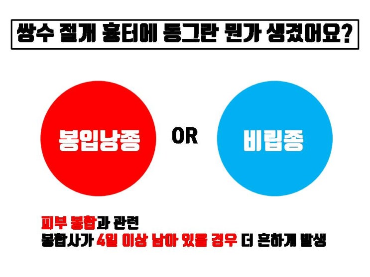  쌍수 라인이 볼록할 땐 쌍수 봉입낭종 아니면 쌍수 비립종!!!