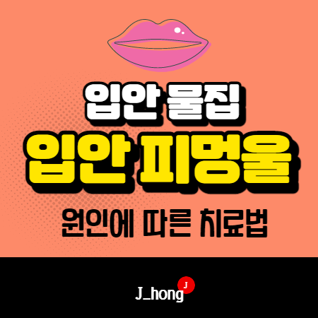 [입안 피멍울] 원인에 따른 치료방법 알아봐요!