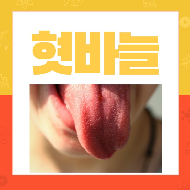  혓바늘 없애는법 도대체 원인이 뭘까