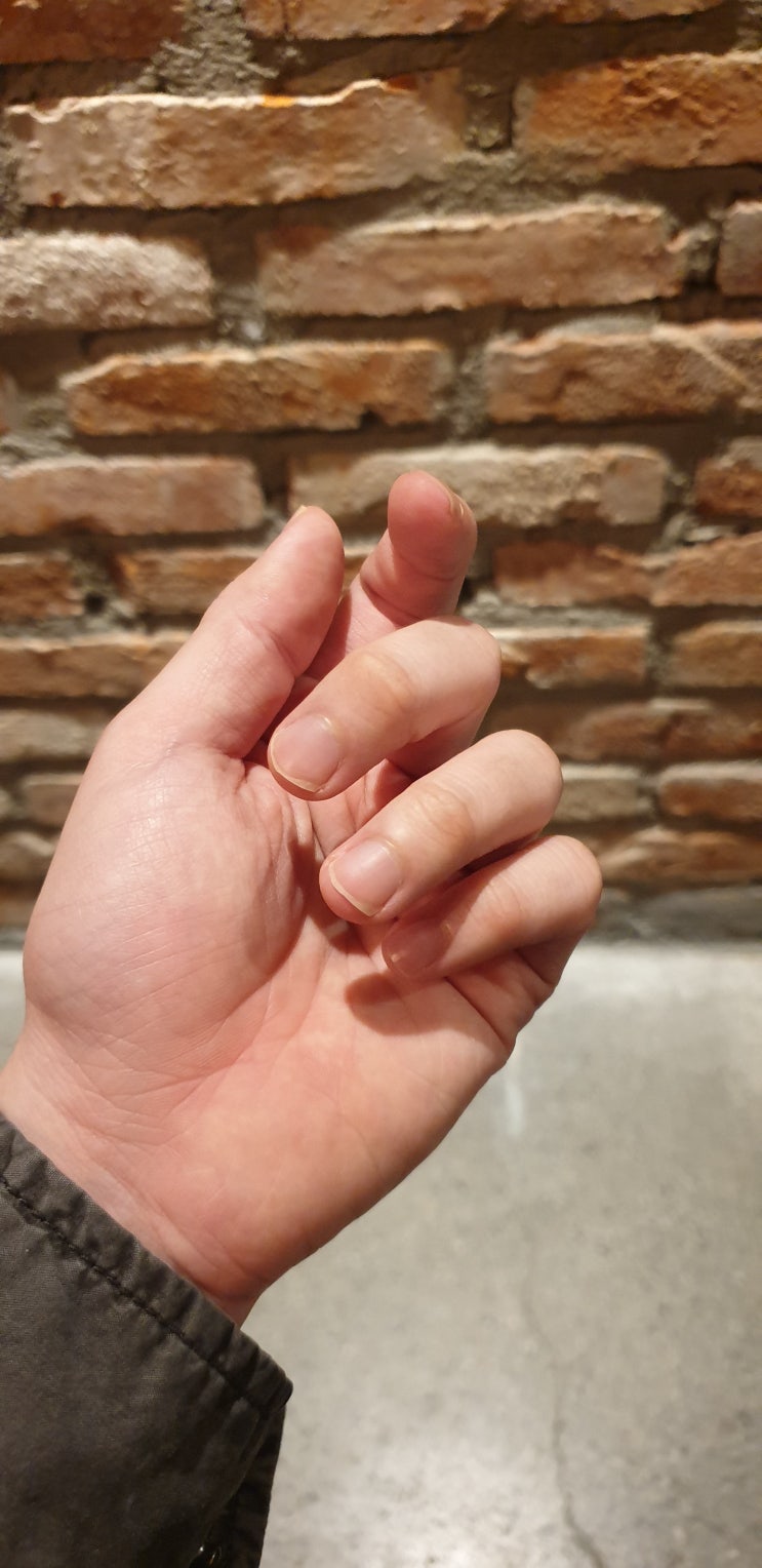  손톱 울퉁불퉁 이유와 해결법 알아봐요