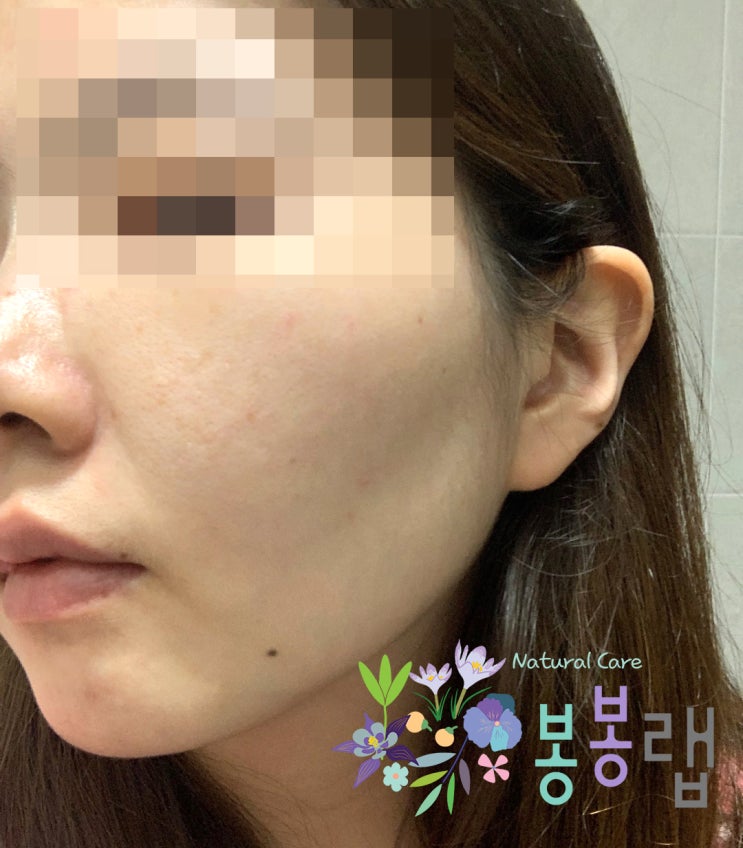  봉봉랩 | 천연비누가 좋은 이유 (+여드름에 좋은 천연비누)