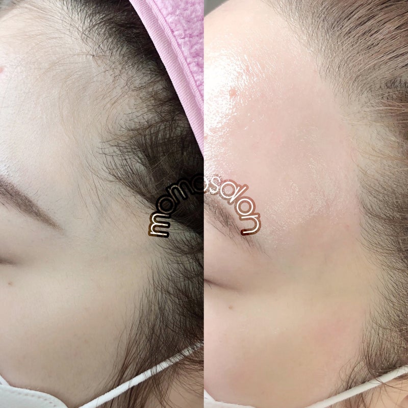 여자 남자 헤어라인 타투 왁스를 알아보자