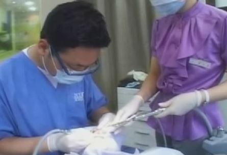  치과 구강전정술 치료로 잇몸을 성형하는 방법