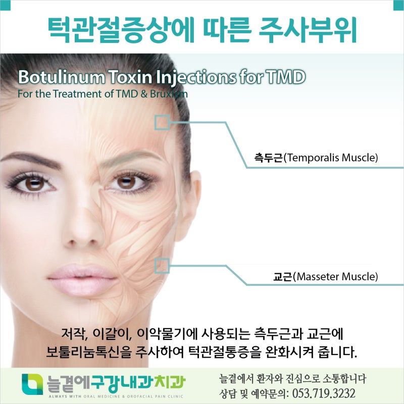 대구턱보톡스 턱통증이 심하다면