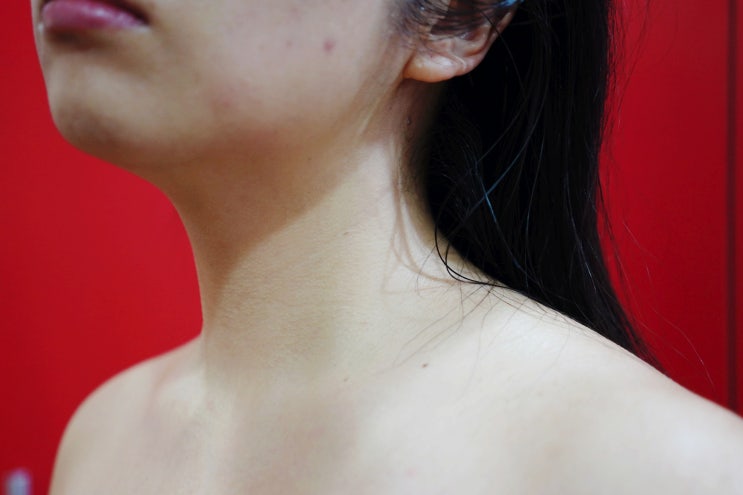  일산피부관리 잘하는 곳! 살롱드보떼 본점 관리받아 본 후기