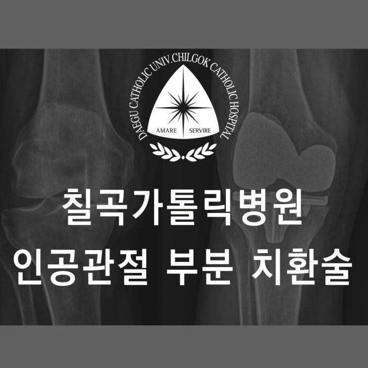  칠곡가톨릭병원 정형외과 인공관절 부분 치환술