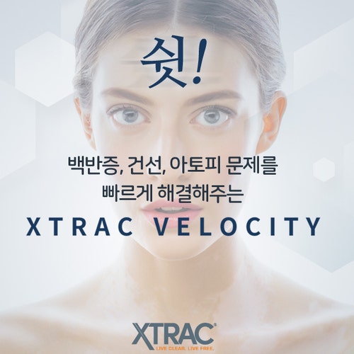 백반증치료비용 부담스럽지 않은 치료
