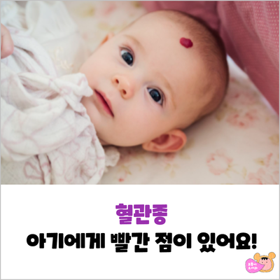  신생아, 아기 혈관종 원인, 치료(레이저, 베타차단제)