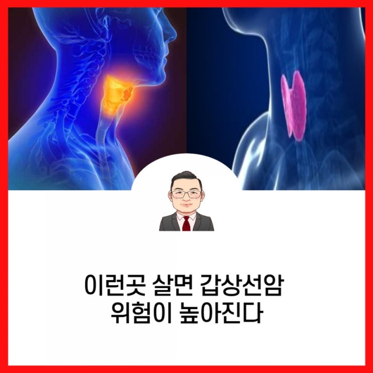  이런곳에 살면 갑상선암 위험이 높아진다