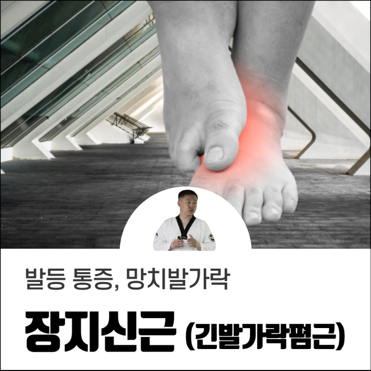  발등 통증, 장지신근 확인 필요합니다.