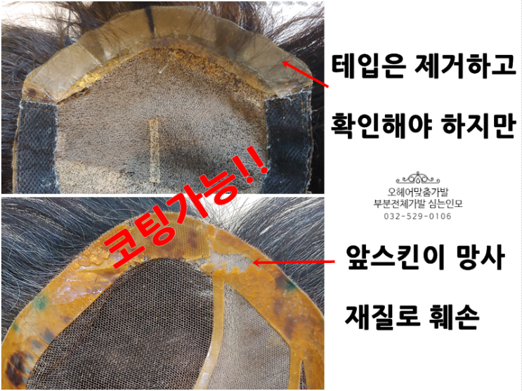  인천가발 맞춤가발 간단 수선수리팁 '앞스킨수선'