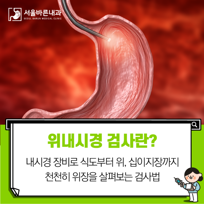 위 내시경 금식시간 위내시경 후 식사 : 물, 약, 음주, 흡연, 검사주기 4