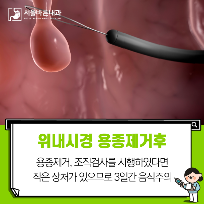 위 내시경 금식시간 위내시경 후 식사 : 물, 약, 음주, 흡연, 검사주기 2