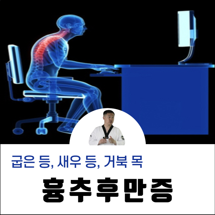  굽은 등 펴기 흉추후만증 운동법