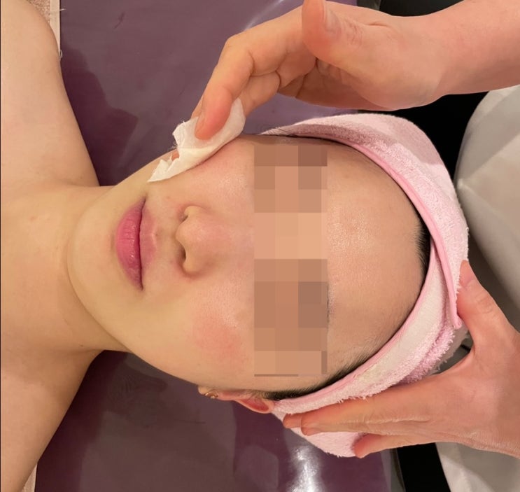  의정부웨딩케어 루비나에서 물톡스 받고 왔어요:)
