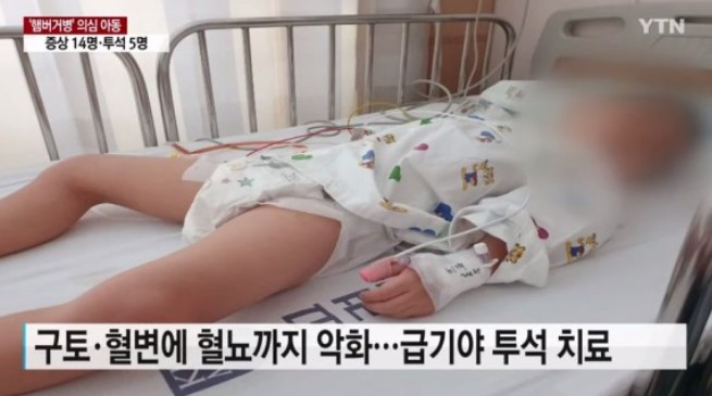 집단 식중독 '햄거버병' 발생한 안산 유치원 원장에 징역 5년 선고 집단 식중독 '햄거버병' 발생한 안산 유치원 원장에 징역 5년 선고