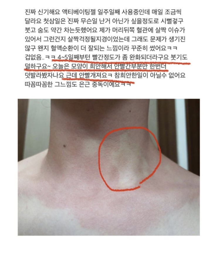  액티베이팅겔 곧 품절이예요! Hurry up ️  다음부터는 가격이 올라요 