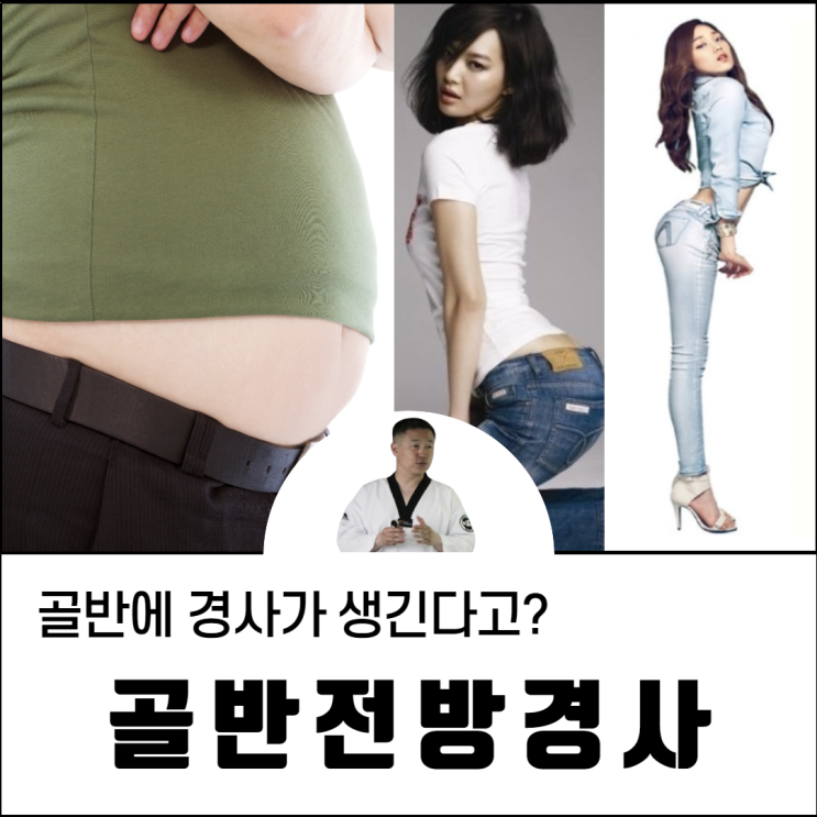  골반전방경사 및 교정 운동에 대해 알려드리겠습니다.