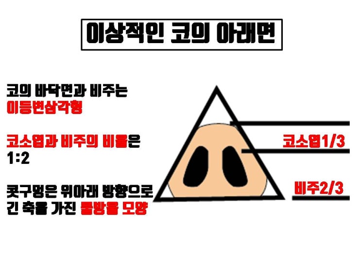  코수술을 하면 모두 콧구멍, 비공이 커 보이고 비대칭이 되나요?  ㅜㅜ