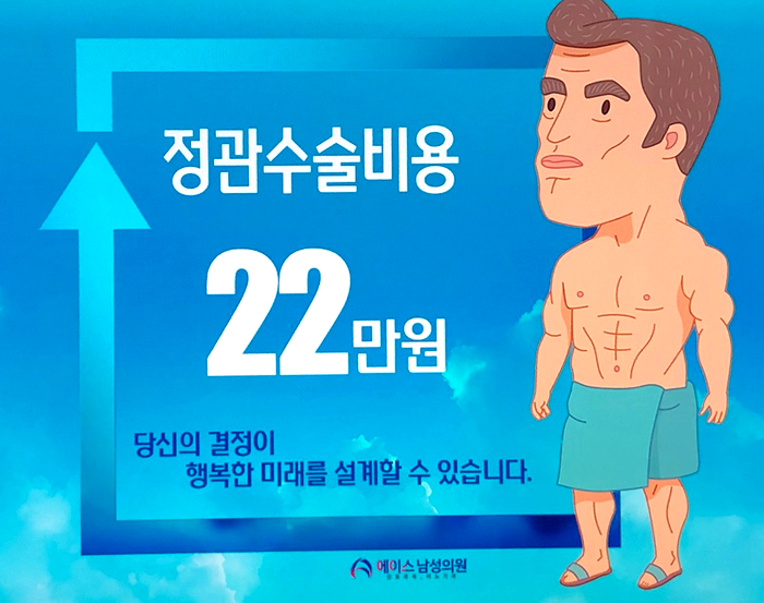 정관수술비, 가장 간편한 피임수술입니다.