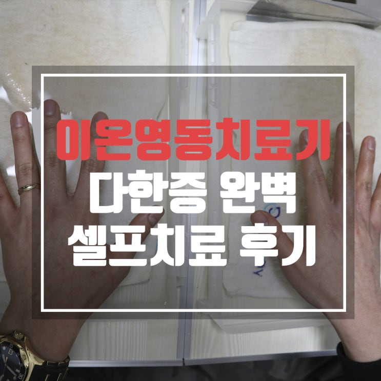  이온영동치료기로 다한증 셀프치료 후기