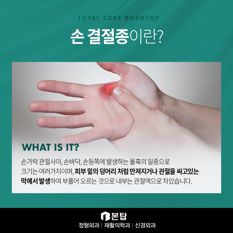 손가락에 결절종이 생긴 후 수술을 해야 하는 이유 12