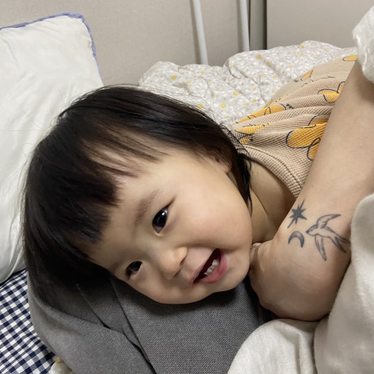  다윤이 육아일기 DAY 480-482 눈탱이밤탱이