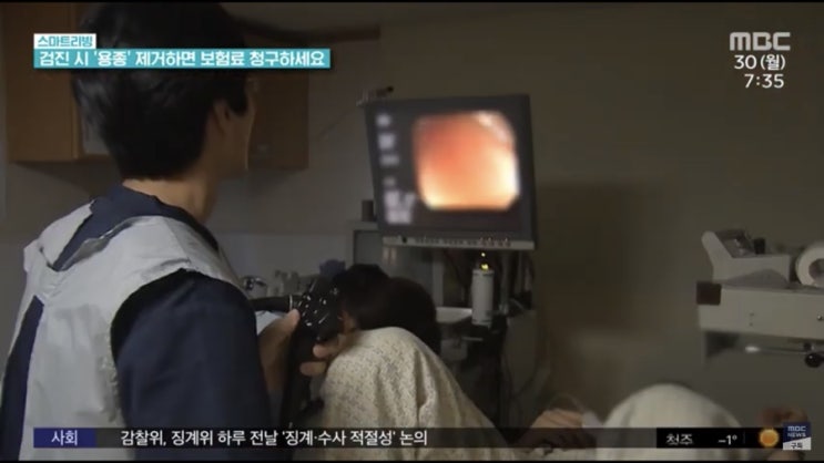  건강 검진시 용종 폴립 제거하면 생명보험 수술비와 실비 보험료 청구가능해요.