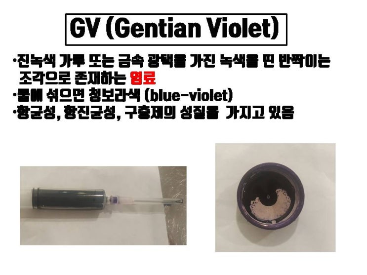 쌍수 후 쌍수 라인 주위에 남은 잉크 자국 억지로 지우면 쌍꺼풀 풀릴 수 있어요.
