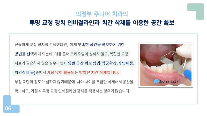 포천교정과는 다양한 교정기기를 보유하고 있어 선택의 폭이 넓습니다. 6