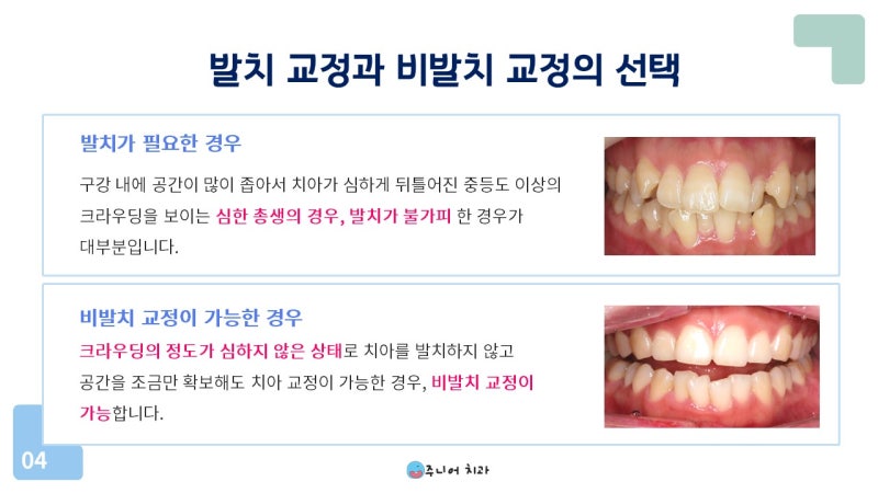 포천교정과는 다양한 교정기기를 보유하고 있어 선택의 폭이 넓습니다. 3